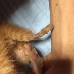 進行する抜け毛