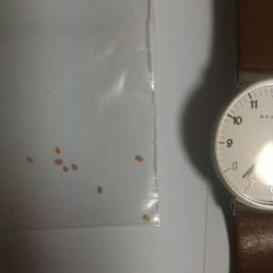 「瓜実条虫（うりざねじょうちゅう）に感染していた。」サムネイル2