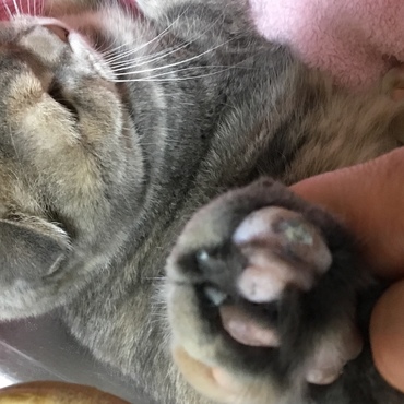 右足、爪の奇形