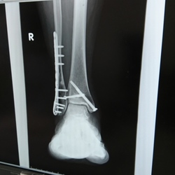 「おんにゃのこ同士+再入院決定」サムネイル3