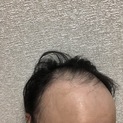 フ