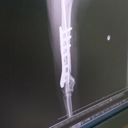 「抜糸をしてきた雉白ちゃん。」サムネイル3