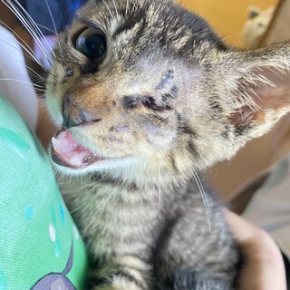 片目失った大雅くん