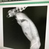 健康優良児認定頂いたんだけども、中性脂肪と血糖値はがんばりましょう