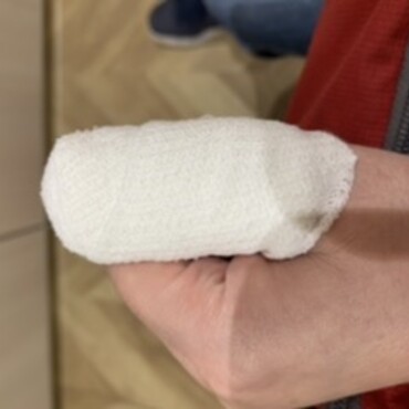包丁で指を切り…3針縫いました…