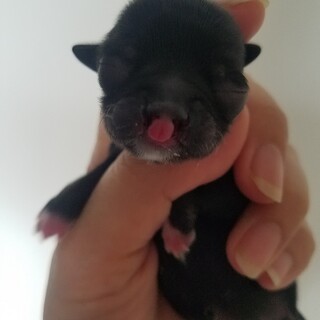 口唇裂の赤ちゃん