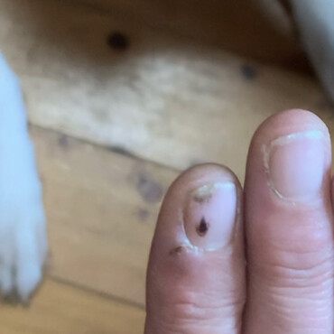 姉様〜あの怪我から保護猫がなすこの傷を量産中