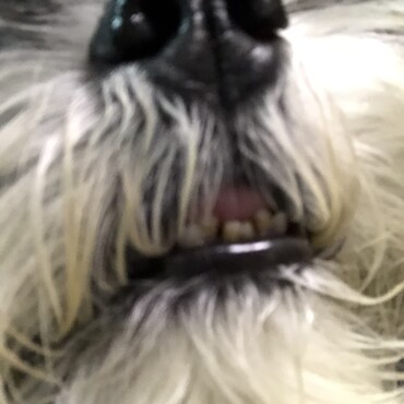 歯